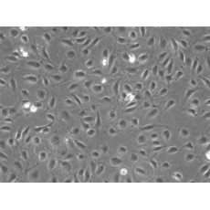 Human Large Intestine Microvascular Endothelial Cells (HLIMEC)